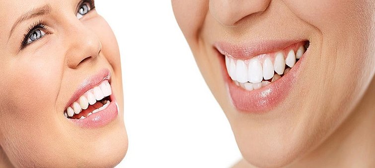 Teeth Whitening Services